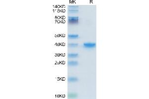 TGFA Protein (AA 39-88) (Fc Tag)