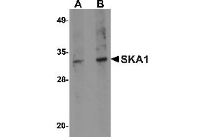 Western blot analysis of SKA1 in A549 cell lysate with SKA1 antibody at (A) 0.
