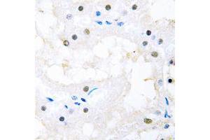 Immunohistochemical analysis of FOXC1/2 staining in human kidney formalin fixed paraffin embedded tissue section. (FOXC1 antibody  (Center))