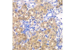 Immunohistochemistry of paraffin-embedded rat kidney using HPD antibody at dilution of 1:100 (x40 lens). (HPD antibody)