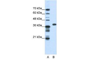 WB Suggested Anti-PCBP1  Antibody Titration: 1.