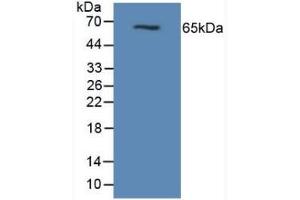 Detection of MUC1 in Mouse Pancreas Tissue using Polyclonal Antibody to Mucin 1 (MUC1) (MUC1 antibody  (AA 474-630))