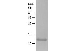Western Blotting (WB) image for Rad6 (AA 1-152) protein (His tag) (ABIN7124771) (Rad6 (AA 1-152) protein (His tag))