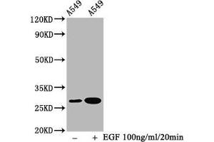 Western Blot Positive WB detected in A549 whole cell lysate(treated with EGF or not) All lanes Phospho-HSPB1 antibody at 1. (Recombinant HSP27 antibody  (pSer78))