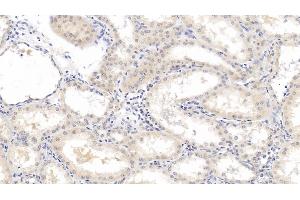 Detection of b2M in Human Kidney Tissue using Monoclonal Antibody to Beta-2-Microglobulin (b2M) (beta-2 Microglobulin antibody  (AA 22-119))