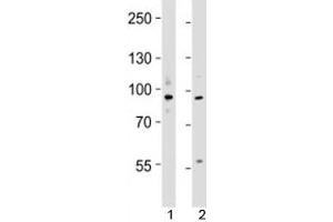 Western blot testing of UHRF1 antibody at 1:4000 dilution; Lane 1: KG-1 lysate, 2: MCF-7 lysate; Predicted molecular weight ~ 88 kDa. (UHRF1 antibody  (N-Term))