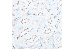 Immunohistochemistry of paraffin-embedded mouse kidney using SSTR5 Rabbit mAb (ABIN7270495) at dilution of 1:100 (40x lens). (SSTR5 antibody)