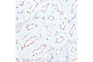 Immunohistochemistry of paraffin-embedded mouse kidney using SSTR5 Rabbit mAb (ABIN7270495) at dilution of 1:100 (40x lens).