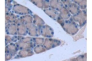 Immunohistochemistry (IHC) image for anti-Interleukin 6 (IL6) (AA 21-211) antibody (ABIN7427093)