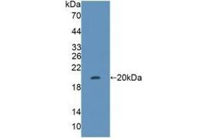 Detection of Recombinant FUM, Human using Polyclonal Antibody to Fumarase (FUM) (FH antibody  (AA 45-188))