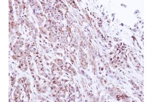 IHC-P Image Immunohistochemical analysis of paraffin-embedded A549 Xenograft, using 20S Proteasome alpha1, antibody at 1:500 dilution. (Proteasome 20S alpha 1 (Center) antibody)