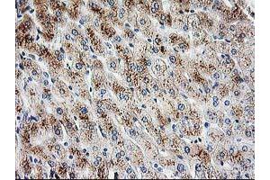 Immunohistochemical staining of paraffin-embedded Human liver tissue using anti-PBX1 mouse monoclonal antibody. (PBX1 antibody)