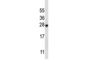 IL-22 antibody western blot analysis in K562 lysate (IL-22 antibody  (AA 44-73))