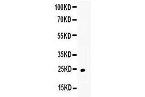 Western blot analysis of TRAIL using anti-TRAIL antibody .