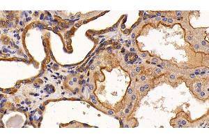 Detection of EGFR in Human Kidney Tissue using Monoclonal Antibody to Epidermal Growth Factor Receptor (EGFR) (EGFR antibody  (AA 888-1210))