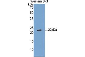 Detection of Recombinant IGFBP1, Porcine using Polyclonal Antibody to Insulin Like Growth Factor Binding Protein 1 (IGFBP1) (IGFBPI antibody  (AA 112-262))