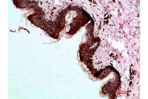 Immunohistochemical analysis of paraffin-embedded human-skin, antibody was diluted at 1:200 (Desmoglein 1 antibody  (AA 30-90))