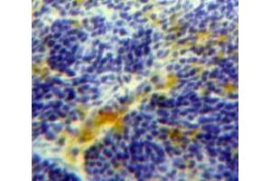 Used in DAB staining on fromalin fixed paraffin-embedded Spleen tissue (FCN1 antibody  (AA 45-249))