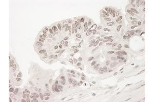 Immunohistochemistry (IHC) image for anti-CREB Regulated Transcription Coactivator 2 (CRTC2) (AA 300-350) antibody (ABIN7448840)