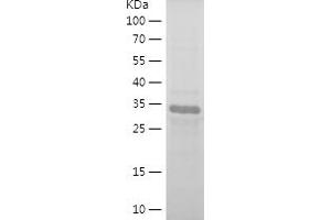 Western Blotting (WB) image for Cyclin-Dependent Kinase Inhibitor 1B (p27, Kip1) (CDKN1B) (AA 90-197) protein (His-IF2DI Tag) (ABIN7122537) (CDKN1B Protein (AA 90-197) (His-IF2DI Tag))