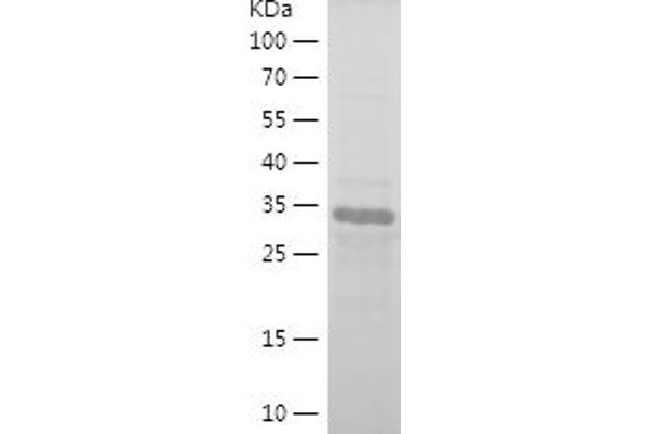 CDKN1B Protein (AA 90-197) (His-IF2DI Tag)