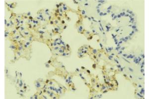ABIN6273909 at 1/100 staining Mouse lung tissue by IHC-P. (SSTR4 antibody  (C-Term))