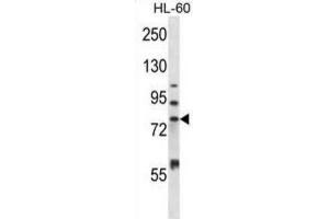 Western Blotting (WB) image for anti-Matrix Metallopeptidase 15 (Membrane-inserted) (MMP15) antibody (ABIN2997513) (MMP15 antibody)