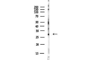 Western blot analysis of lysates from EC304 cells(heat-shock,45 min treatment), using METRN Antibody at 1/1000 dilution.