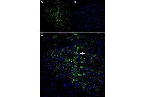 Expression of CaVγ6 (CACNG6) in rat brain - Immunohistochemical staining of rat cingulate cortex using Anti-CACNG6 (extracellular) Antibody (ABIN7042994, ABIN7044055 and ABIN7044056), (1:400).