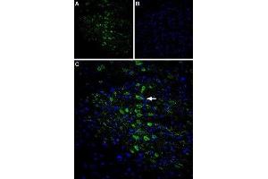 Expression of CaVγ6 (CACNG6) in rat brain - Immunohistochemical staining of rat cingulate cortex using Anti-CACNG6 (extracellular) Antibody (ABIN7042994, ABIN7044055 and ABIN7044056), (1:400). (CACNG6 antibody  (1st Extracellular Loop))