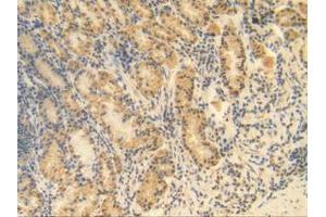 IHC-P analysis of Human Stomach Tissue, with DAB staining. (MGP antibody  (AA 1-103))
