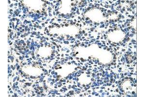 Image no. 1 for anti-protein ariadne-2 homolog (ARIH2) (N-Term) antibody (ABIN203288) (ARIH2 antibody  (N-Term))