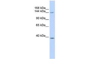 SMC4 antibody used at 1 ug/ml to detect target protein. (SMC4 antibody  (Middle Region))