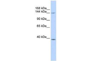 SMC4 antibody used at 1 ug/ml to detect target protein.