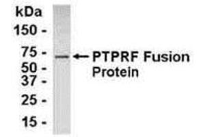 Western Blotting (WB) image for anti-Protein Tyrosine Phosphatase Receptor Type F (PTPRF) (AA 1151-1225) antibody (ABIN2467995) (PTPRF antibody  (AA 1151-1225))