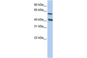 Western Blotting (WB) image for anti-5'-Nucleotidase, Cytosolic III (NT5C3) antibody (ABIN2460388)