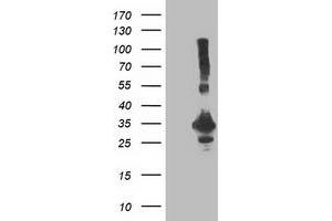 Western Blotting (WB) image for anti-Phenylethanolamine N-Methyltransferase (PNMT) antibody (ABIN1500308) (PNMT antibody)