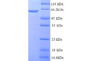 Chromosome 1 Open Reading Frame 106 (C1ORF106) (AA 1-578), (full length) protein (His tag)