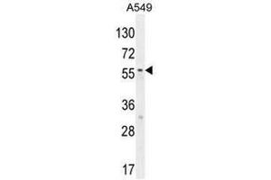 SYNCI Antibody (N-term) western blot analysis in A549 cell line lysates (35µg/lane). (Syncoilin antibody  (N-Term))