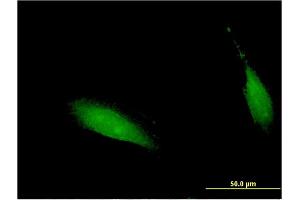 Immunofluorescence of monoclonal antibody to CENPV on HeLa cell.