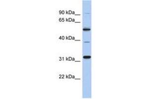 Image no. 1 for anti-TBC1 Domain Family, Member 26 (TBC1D26) (AA 107-156) antibody (ABIN6743882) (TBC1D26 antibody  (AA 107-156))