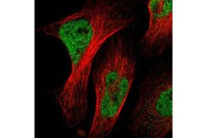 Immunofluorescent staining of U-2 OS with NACC1 polyclonal antibody  (Green) shows positivity in nucleus but excluded from the nucleoli.