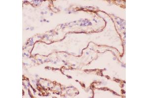 Anti-Collagen IV Picoband antibody,  IHC(P): Human Lung Cancer Tissue (COL4A1 antibody  (AA 1445-1669))