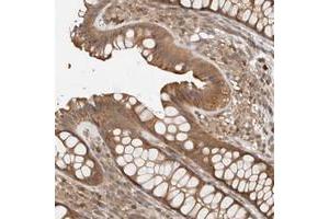 Immunohistochemical staining of human colon with ADSS polyclonal antibody  shows moderate cytoplasmic positivity in glandular cells at 1:20-1:50 dilution. (ADSS antibody)