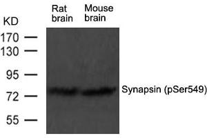 Western blot analysis of extract from rat brain and mouse brain tissue using Synapsin(phospho-Ser549) Antibody using (SYN1 antibody  (pSer549))