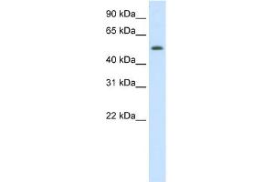 WB Suggested Anti-DIDO1 Antibody Titration:  0. (DIDO1 antibody  (N-Term))