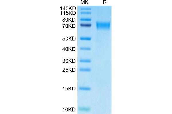 CD39 Protein (AA 38-478) (His tag)