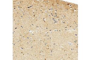 IHC analysis of UBE3A using anti-UBE3A antibody (ABIN7599562). (ube3a antibody  (AA 1-860))