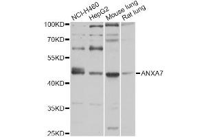 Western blot analysis of extracts of various cell lines, using ANXA7 antibody (ABIN5971923) at 1/1000 dilution. (Annexin VII antibody)