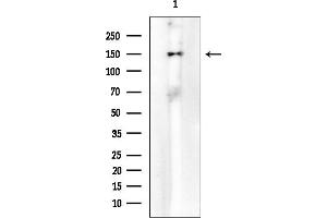 anti-High Density Lipoprotein Binding Protein (HDLBP) (N-Term) antibody